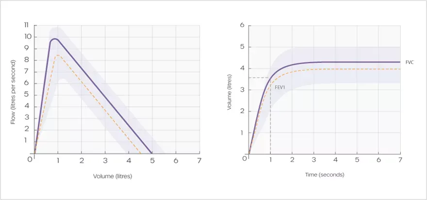 how-to-interpret-spirometry-test-results